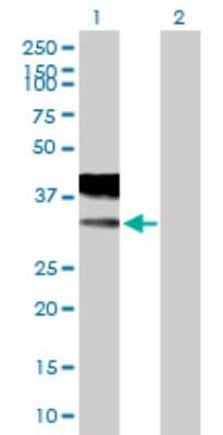 Western Blot: Stargazin Antibody [H00010369-B01P]