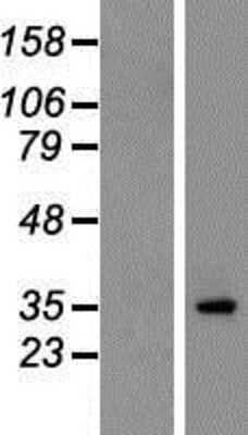 Western Blot: Stargazin Overexpression Lysate [NBP2-10433]