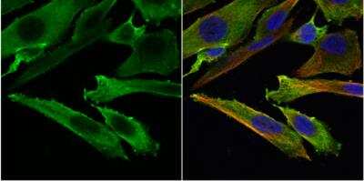 Immunocytochemistry/ Immunofluorescence: Stathmin 1 Antibody [NBP1-30883]
