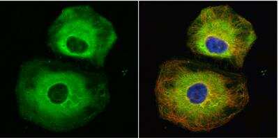 Immunocytochemistry/ Immunofluorescence: Stathmin 1 Antibody [NBP1-30883]