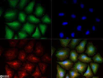 Immunocytochemistry/ Immunofluorescence: Stathmin 1 Antibody - BSA Free [NBP1-76798]