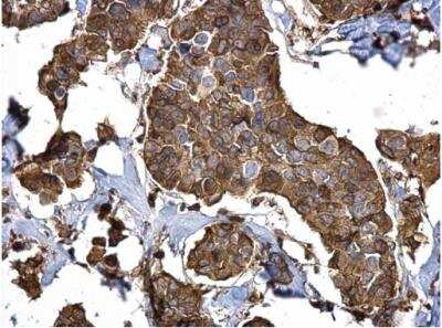 Immunohistochemistry-Paraffin: Stathmin 1 Antibody [NBP1-30883]