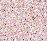 Immunohistochemistry-Paraffin: Stathmin 1 Antibody - BSA Free [NBP1-76798]
