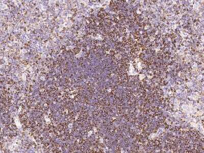 Immunohistochemistry-Paraffin: Stathmin 1 Antibody [NBP2-99433]