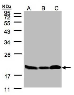 Western Blot: Stathmin 1 Antibody [NBP1-30883]
