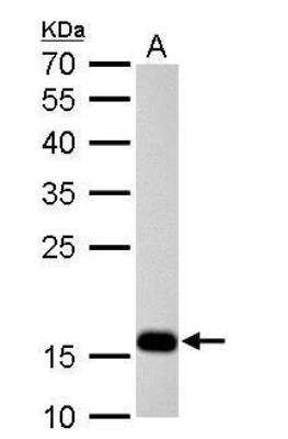 Western Blot: Stathmin 1 Antibody [NBP1-30883]