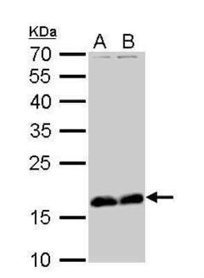 Western Blot: Stathmin 1 Antibody [NBP1-30883]
