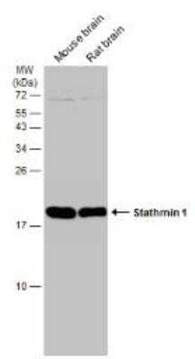 Western Blot: Stathmin 1 Antibody [NBP1-30883]