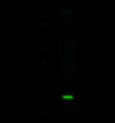 Western Blot: Stathmin 1 Antibody [NBP2-98752]