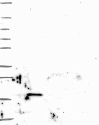 Western Blot: Stathmin 1 Antibody [NBP3-16977]