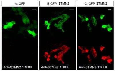 Immunocytochemistry/Immunofluorescence Staining of Stathmin-2/STMN2 in Transfected HEK293T Cells
