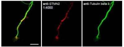 Immunocytochemistry/Immunofluorescence Analysis of Stathmin-2/STMN2 in Mouse DRG Neurons