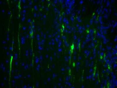 Immunohistochemical Detection of Stathmin-2/STMN2 in Frozen Mouse Trigeminal Root Entry Zone