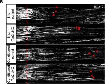 Immunohistochemical Staining of Stathmin-2/STMN2 in Frozen Mouse Sciatic Nerves