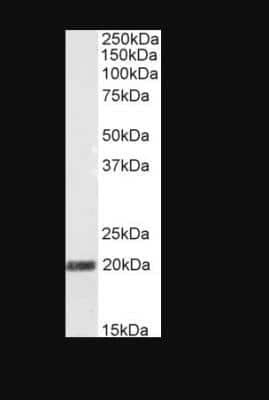 Western Blot: Stathmin-2/STMN2 Antibody [NB100-1403]