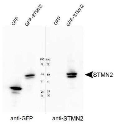 Western Blot Analysis of Stathmin-2/STMN2 in Transfected HEK293T Cells