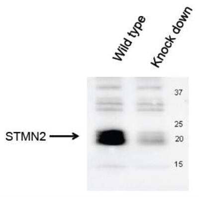 Knockdown Validation of Stathmin-2/STMN2 Antibody in Mouse DRG Neurons by Western Blot