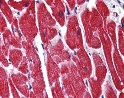 Immunohistochemistry-Paraffin: Staufen Antibody [NBP1-57386]