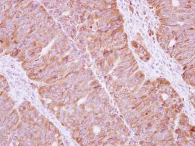 Immunohistochemistry-Paraffin: Staufen Antibody [NBP2-20508]