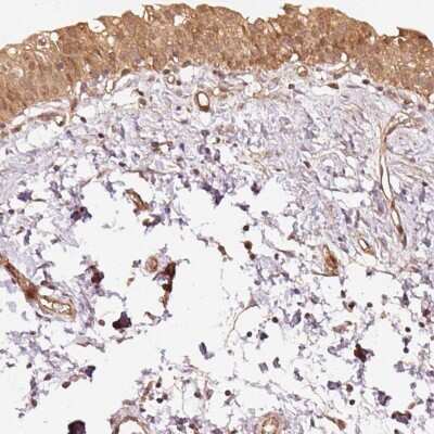 Immunohistochemistry-Paraffin: Staufen Antibody [NBP2-38615]
