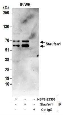 Immunoprecipitation: Staufen Antibody [NBP2-22308]