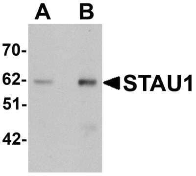 Western Blot: Staufen AntibodyBSA Free [NBP1-76303]