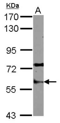 Western Blot: Staufen Antibody [NBP2-20508]