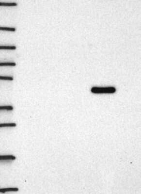 Western Blot: Staufen Antibody [NBP3-17204]