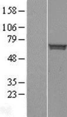 Western Blot: Staufen Overexpression Lysate [NBL1-16531]