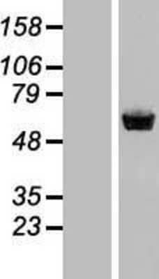 Western Blot: Staufen Overexpression Lysate [NBL1-16532]