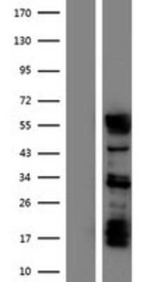 Western Blot: Staufen Overexpression Lysate [NBP2-10618]