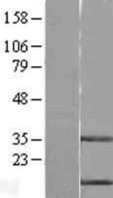 Western Blot: Cystatin B/Stefin B Overexpression Lysate [NBL1-09554]