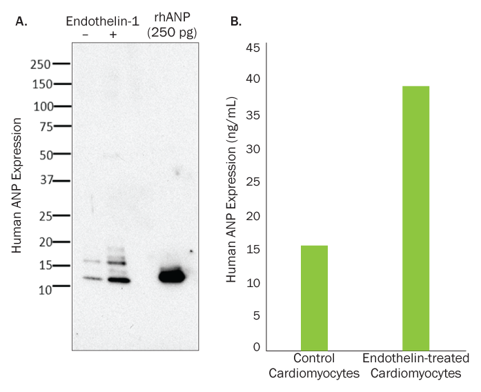 Endothelin-1 Induces Expression of Atrial Natriuretic Peptide in Cardiomyoctyes Derived from iPSCs Using the New Kit.
