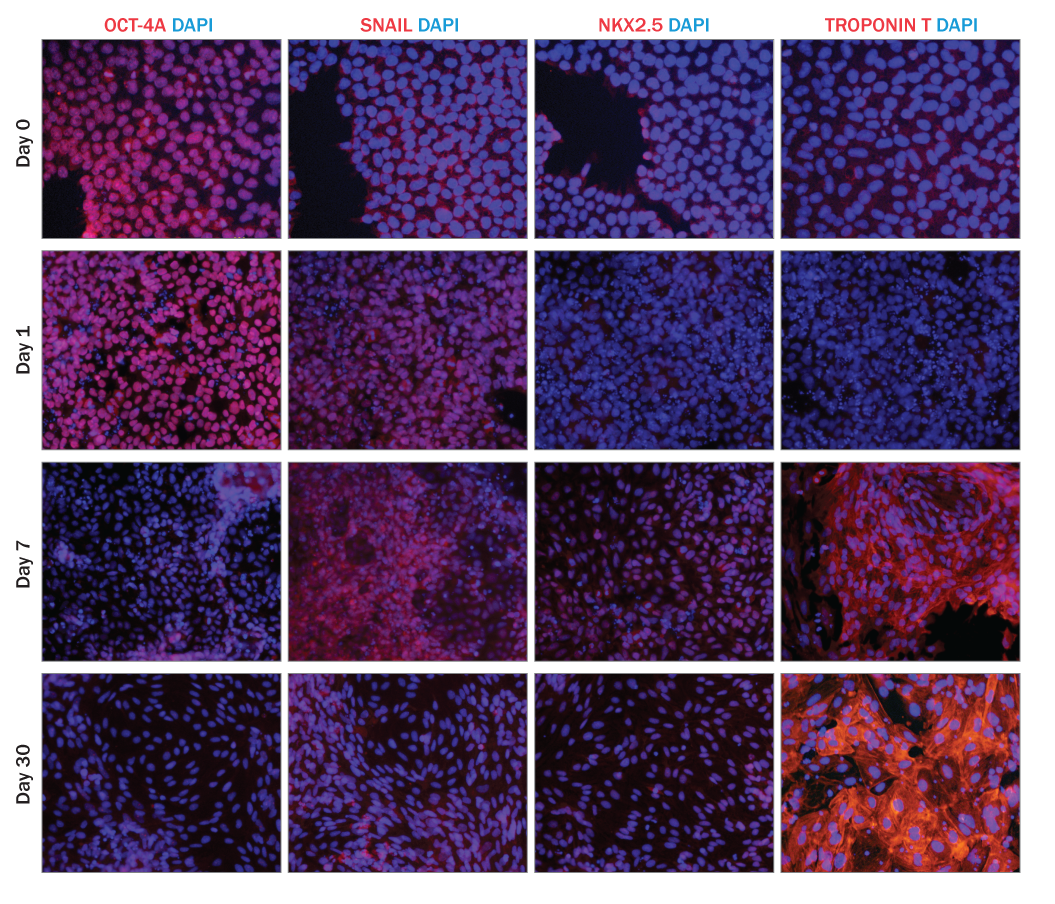Kit-Derived Cardiomyocytes Express Stage-specific Markers During Differentiation.