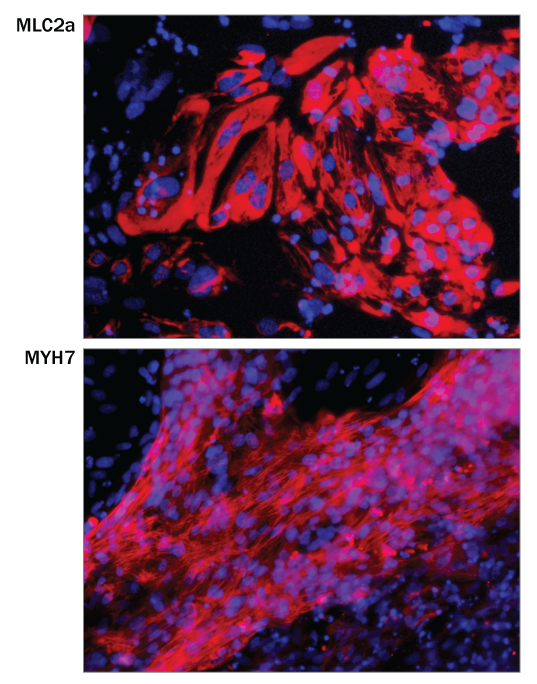 Kit-Derived Cardiomyocytes Express Atrial and Ventricular Markers. 