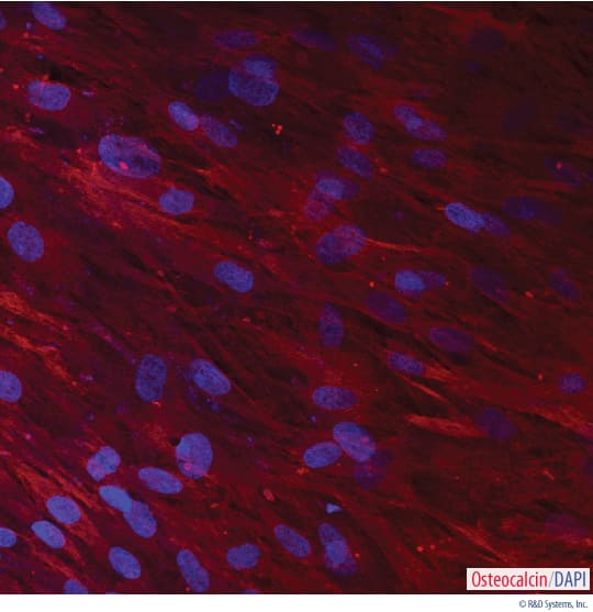 Detection of Osteocalcin in Human MSC-differentiated Osteocytes.