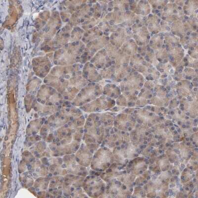 Immunohistochemistry-Paraffin: Steroid sulfatase Antibody [NBP1-90095]