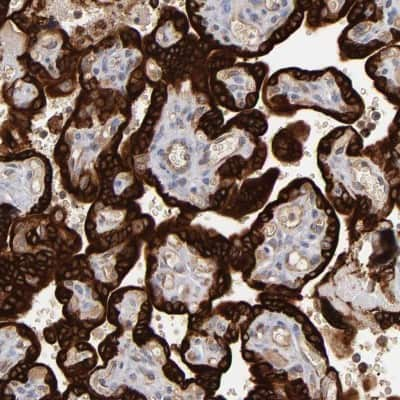 Immunohistochemistry-Paraffin: Steroid sulfatase Antibody [NBP1-90095]