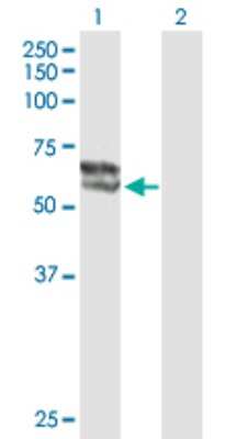 Western Blot: Steroid sulfatase Antibody [H00000412-B01P]