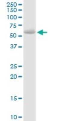 Western Blot: Steroid sulfatase Antibody [H00000412-D01P]