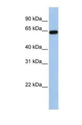 Western Blot: Steroid sulfatase Antibody [NBP1-69686]