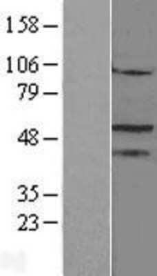 Western Blot: SF-1/NR5A1/Steroidogenic Factor 1 Overexpression Lysate [NBL1-13782]