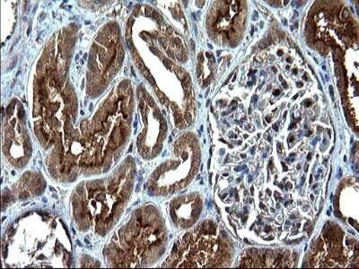 Immunohistochemistry: Sterol carrier protein 2 Antibody (OTI1E4) [NBP2-45726]