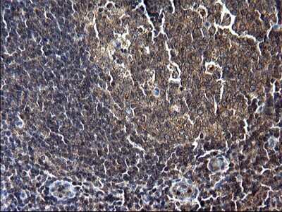Immunohistochemistry: Sterol carrier protein 2 Antibody (OTI1E4) [NBP2-45726]