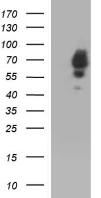 Western Blot: Sterol carrier protein 2 Antibody (OTI1E4) [NBP2-45726]