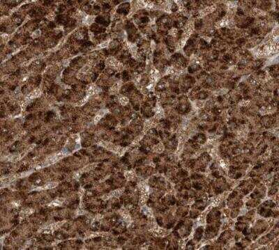 Immunohistochemistry-Paraffin: Sterol carrier protein 2 Antibody [NBP1-85958]