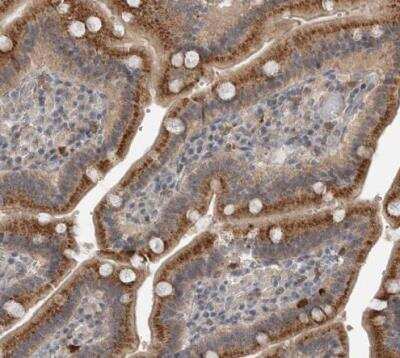 Immunohistochemistry-Paraffin: Sterol carrier protein 2 Antibody [NBP1-85958]
