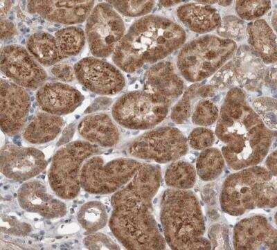 Immunohistochemistry-Paraffin: Sterol carrier protein 2 Antibody [NBP1-85958]