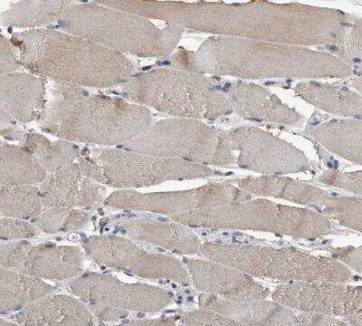 Immunohistochemistry-Paraffin: Sterol carrier protein 2 Antibody [NBP1-85958]