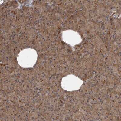 Immunohistochemistry-Paraffin: Sterol carrier protein 2 Antibody [NBP1-89514]
